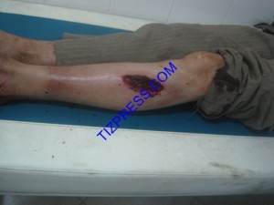 اعتداء_الخنزير_البري_تافراوت_50-Copier