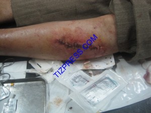 اعتداء_الخنزير_البري_تافراوت_60-Copier
