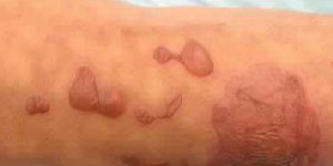 أنباء عن اعتداء شنيع على طفل ذو 04 سنوات بجماعة أنفك من طرف والدته