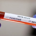 جهة كلميم وادنون تسجل صفر إصابة بـفيروس 