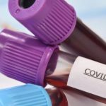 جهة كلميم واد نون .. حالتان جديدتان ترفع حصيلة 